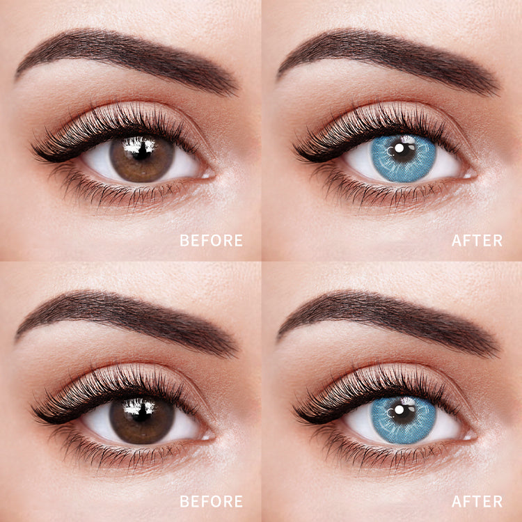 Comparison of the Effects Before and After Wearing Sparkling Blue Contact Lenses