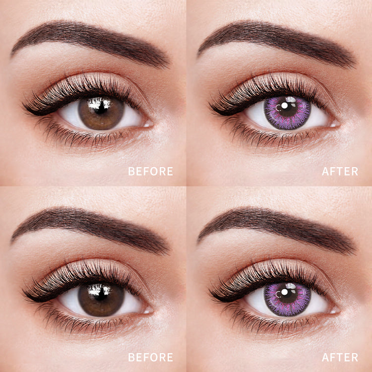 Comparison of the Effects Before and After Wearing Neon Pulse Purple Contact Lenses