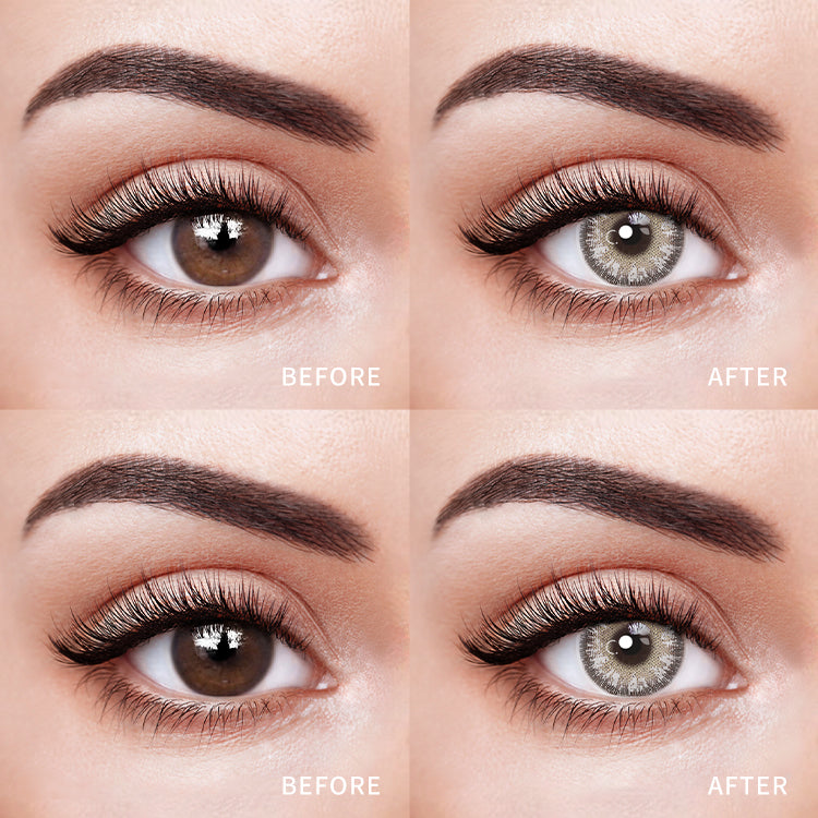 Comparison of the Effects Before and After Wearing Magic Gray Contact Lenses