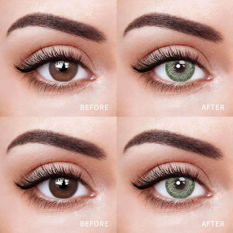 Comparison of the Effects Before and After Wearing Topaz Green Contact Lenses