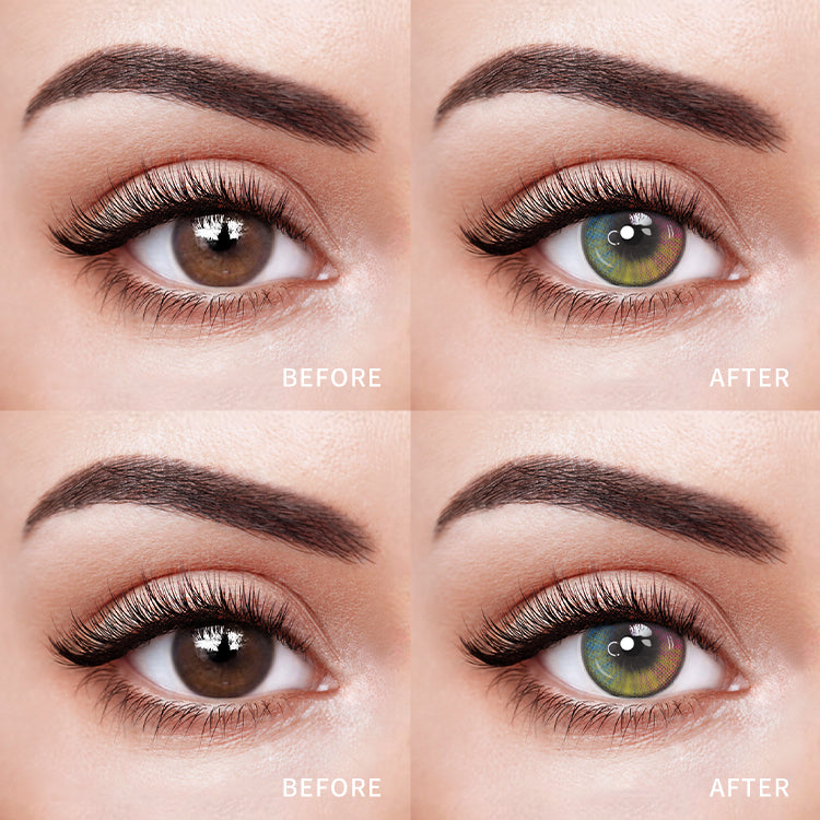 Comparison of the Effects Before and After Wearing Prism Bloom Contact Lenses